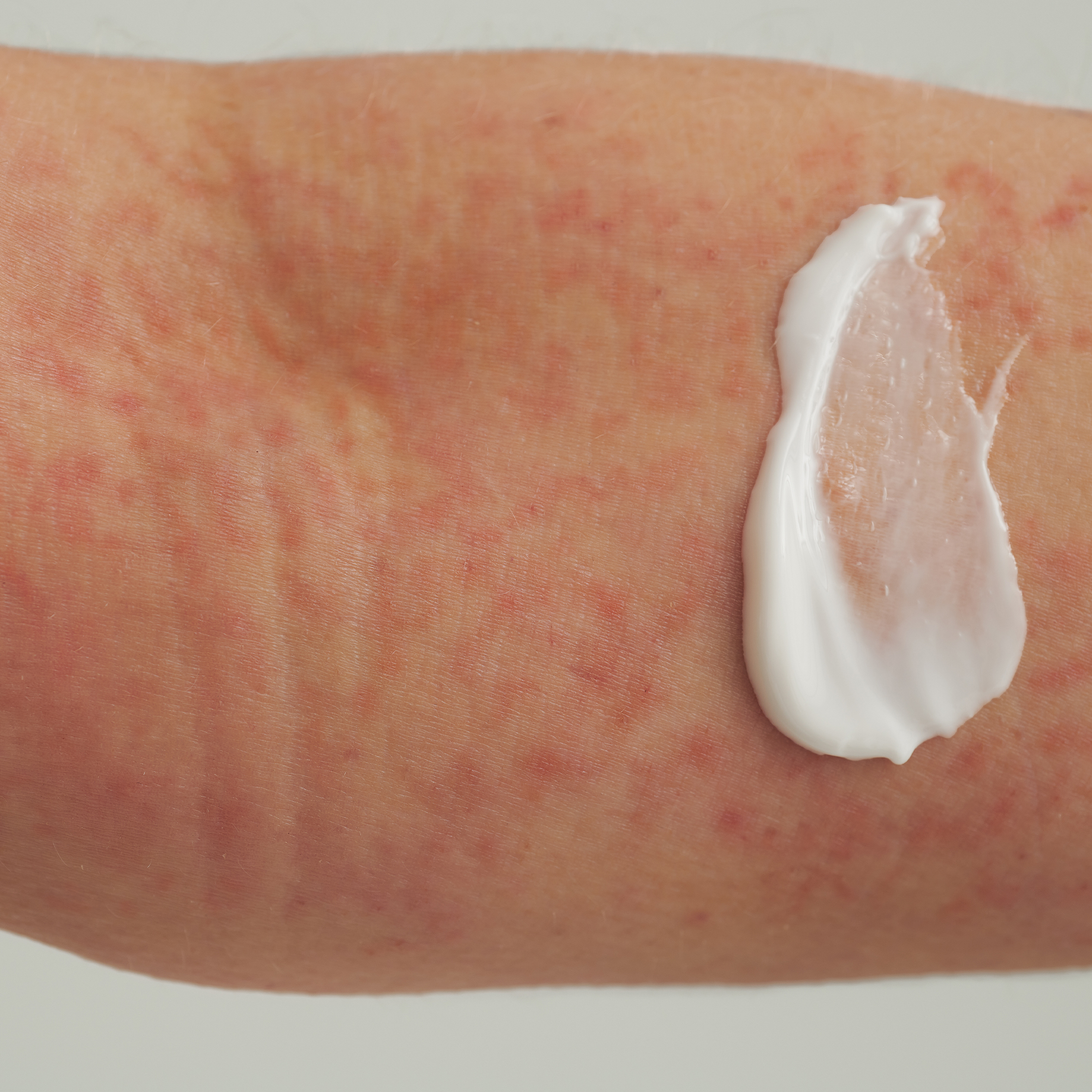 EXTRODERM DUSCHCREME