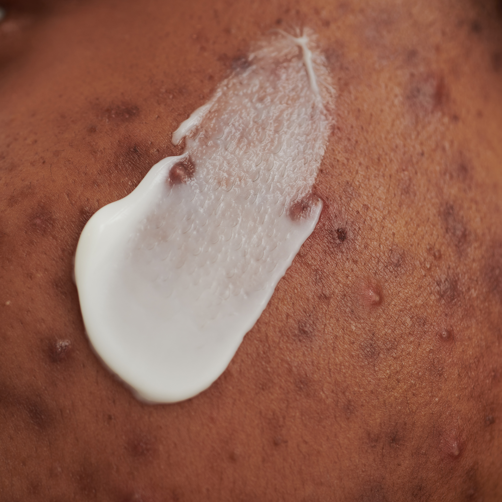 PURDERM WASCHCREME