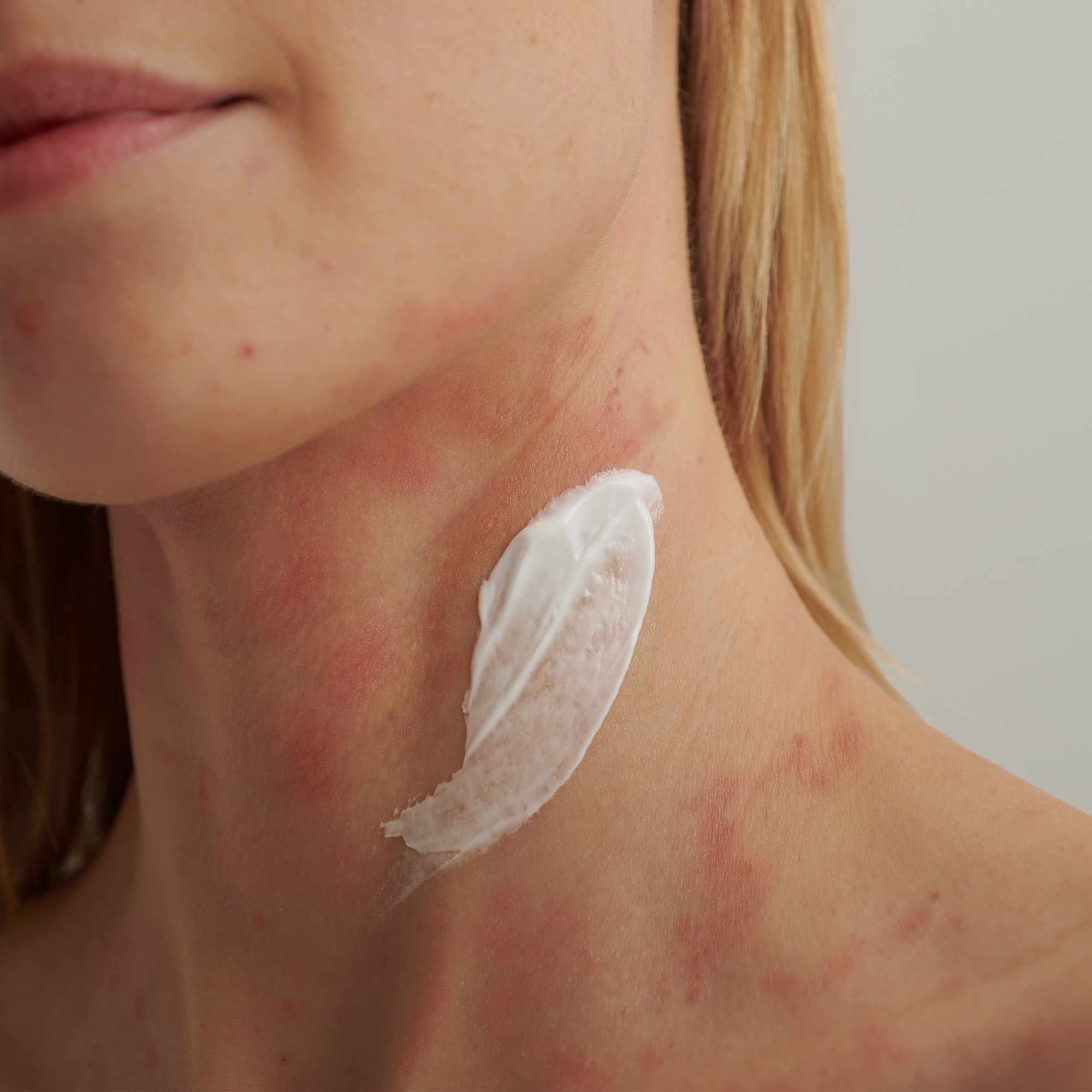 EXTRODERM INTENSIVCREME